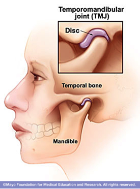 TMJ image