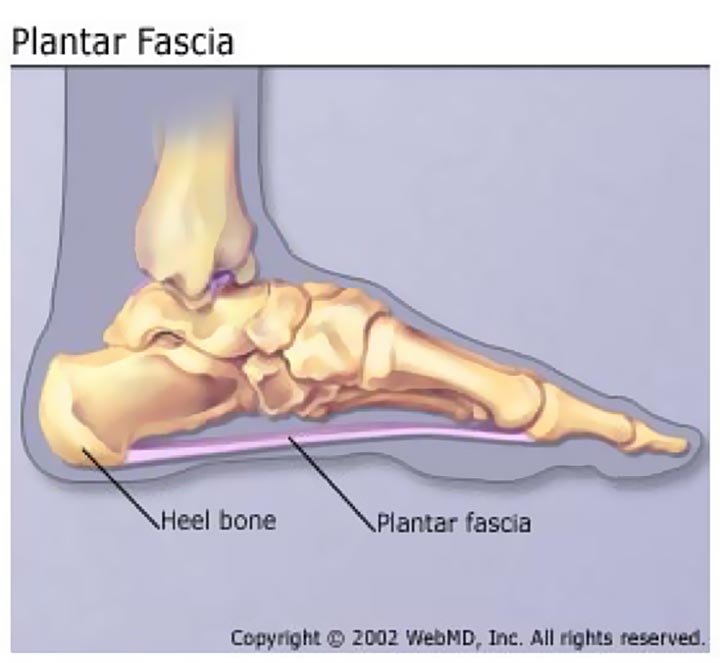 plantar-fascia.jpg