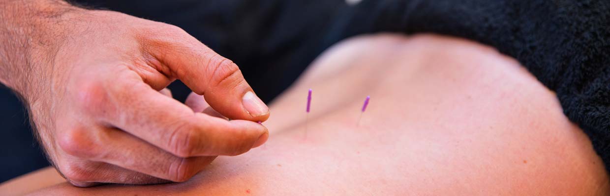 Dry Needling in Bournemouth